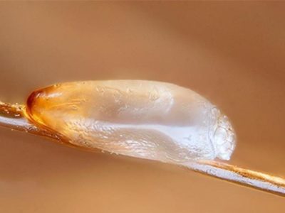 Фото: Увеличенное изображение гниды Увеличенное изображение гниды