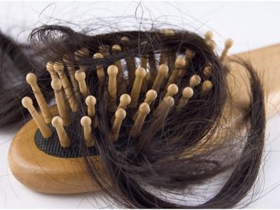 Выпадение волос у подростков девочек причины